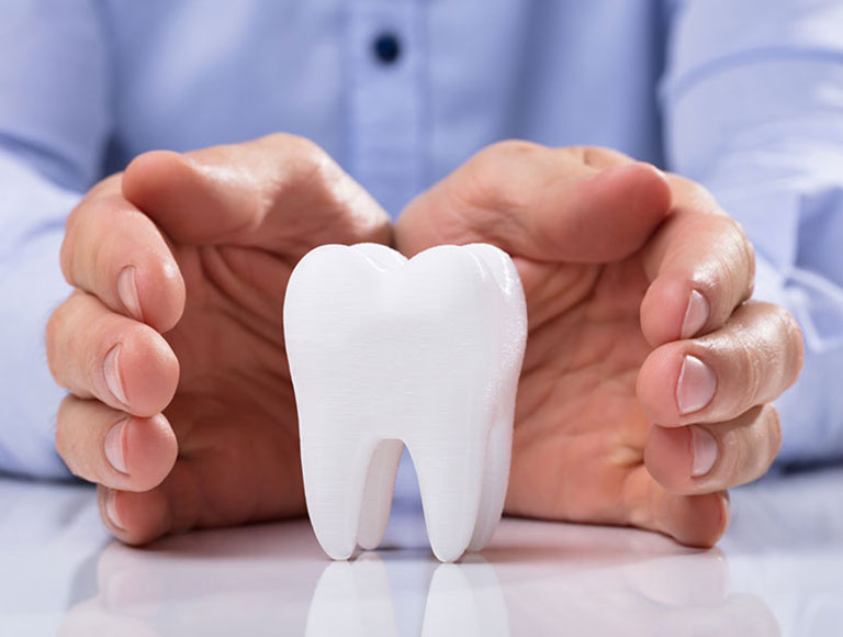 Insurance and Dental Implants